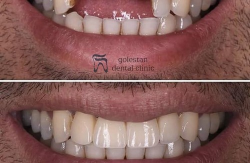 دندانپزشکی شبانه روزی گلستان