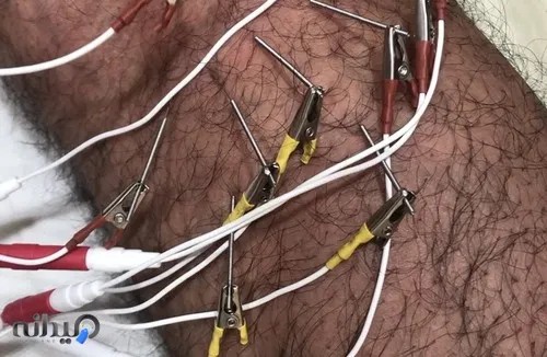 کلینیک فیزیوتراپی ضیاشمس