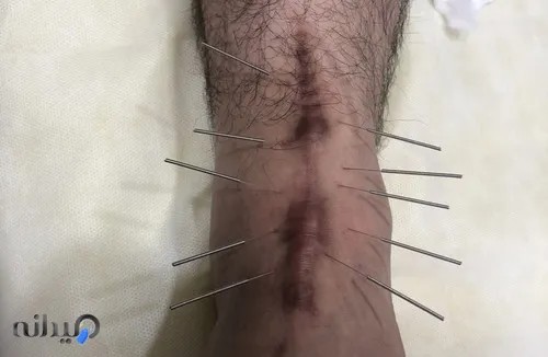 کلینیک فیزیوتراپی ضیاشمس