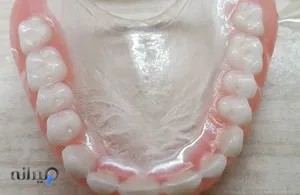 پروتزیست اسماعیل فرجامی