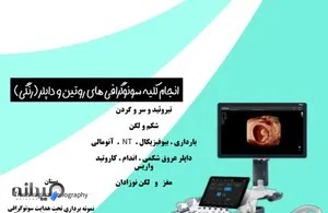 سونوگرافی دکتر حسن نیا 