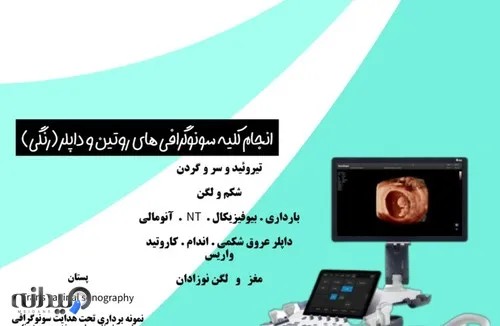 سونوگرافی دکتر حسن نیا 