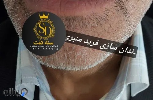 دندانسازی سنه دنت(سنندج)