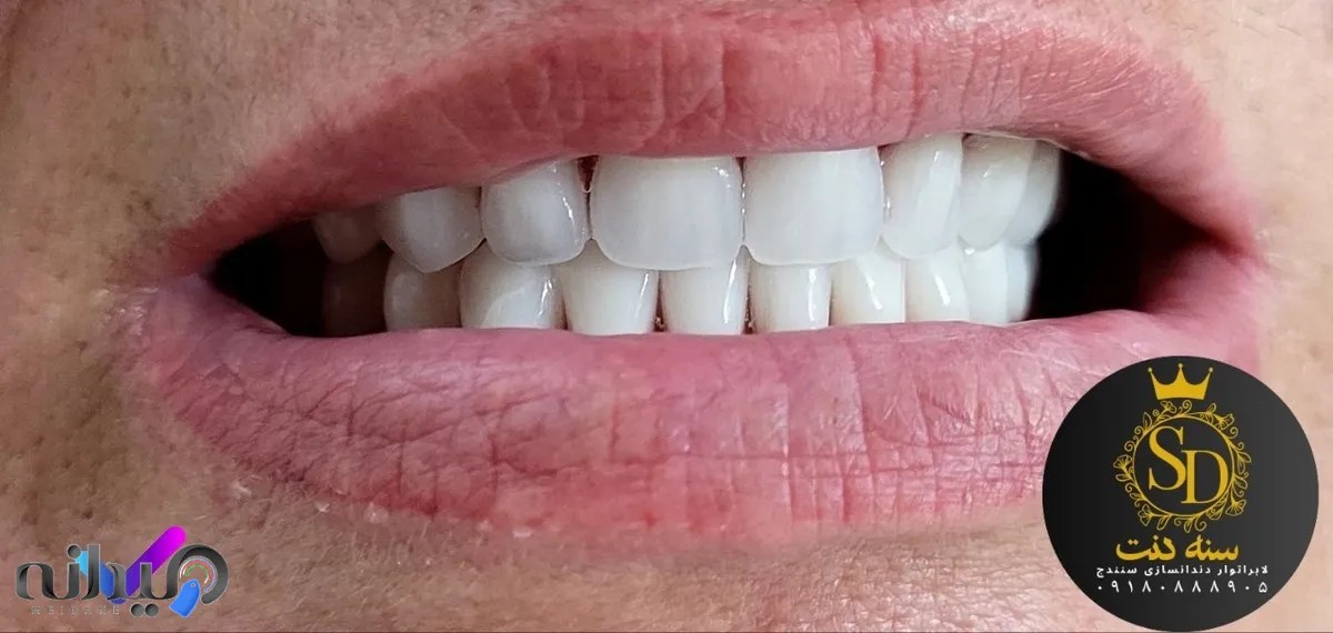 دندانسازی سنه دنت(سنندج)