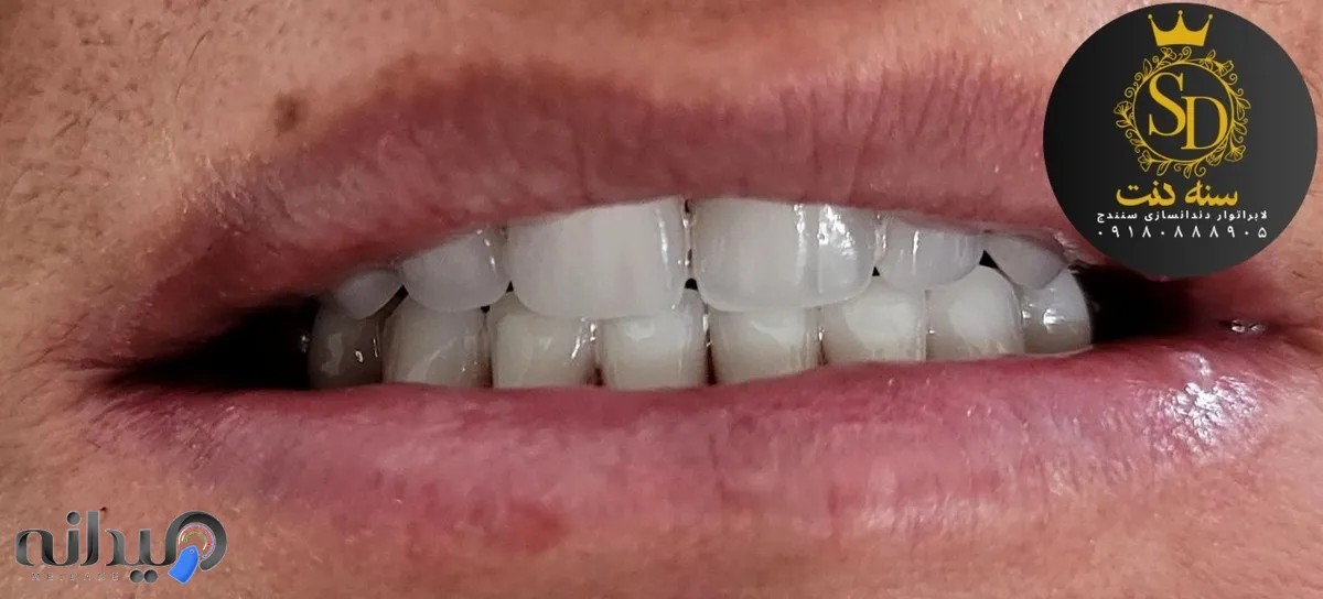 دندانسازی سنه دنت(سنندج)