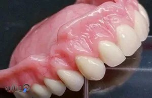 Moghaddam Denture Clinic 