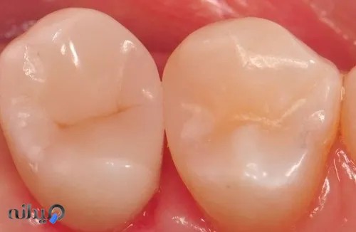 دکتر مهدی فتحی