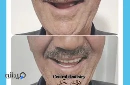 دندانسازی سانترال 