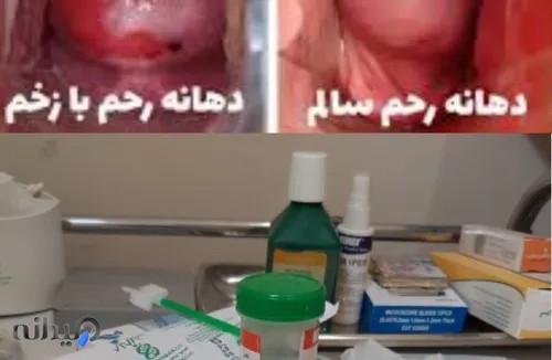 مطب زنان معصومه تقی پور