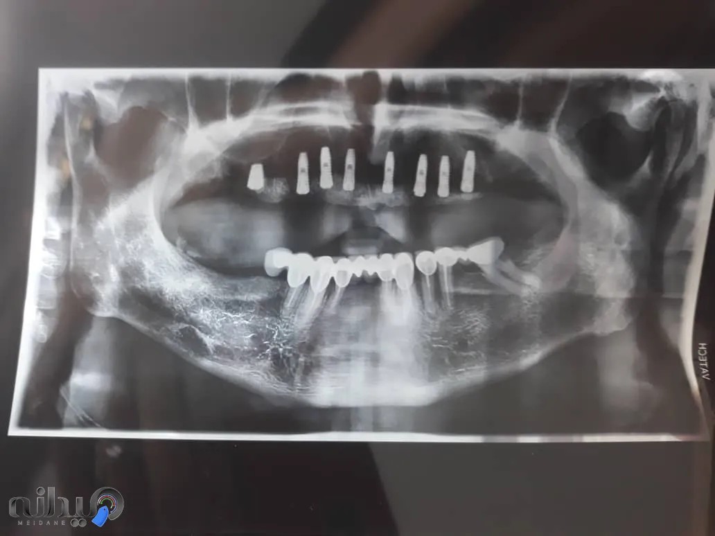 دندانپزشکی کیمیای شهریار 
