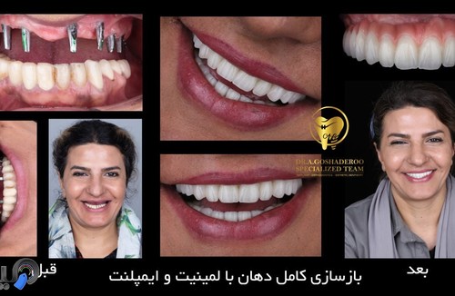 دکتر عزیز گشاده رو