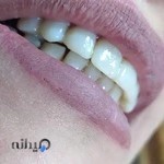 فارغ التحصیل دانشکده دندانپزشکی تهران