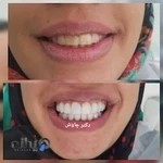 دندانپرشکی دکتر چاوش
