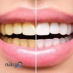 دندانپزشکی دکتر هویدایی | Dr Hoveidaei Dental Clinic