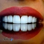 کلینیک دندانپزشکی مستردنتو mrdento