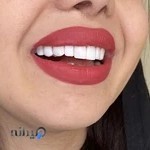 دندانپزشکی زیبایی رومینا