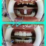 دندانپزشکی لبخند
