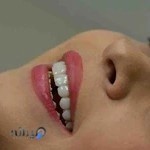 دندانپزشکی زیبایی کرج