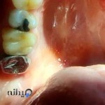 مجتمع ایمپلنت های دندانی دکتر شاپور فراهانی