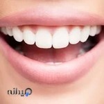 مطب دندانپزشکی تهران اسمایل