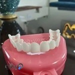 دندانپزشکی دکتر الهام مرادی | ارتودنسی |ایمپلنت |زیبایی و لمینت سرامیکی کامپوزیت | اطفال