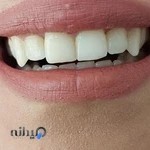دندانپزشکی دکتر علی عزیزی