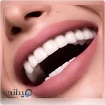 دندانسازی وحید اصفهان