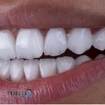 دندانپزشکی و دندانسازی رودکی