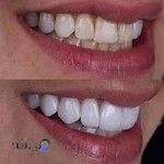 دندانسازی ستارپور