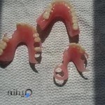 دندانسازی گودرزی