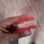 دندانسازی رباط