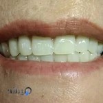 دندانسازی یزدانی
