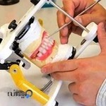 دندانسازی صدف