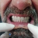 لابراتوار دندانسازی Apple