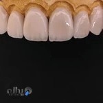 لابراتوار دندانسازی مروارید سیاه کرج