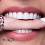 دندانپزشک اسلام شهر | خانم دکتر شیدا بیابانی