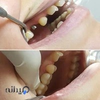 مطب دندانپزشکی دکتر حسن رمضانی Dentist