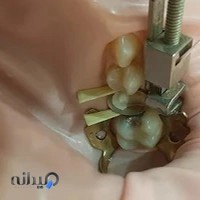 مطب دندانپزشکی دکتر مرتضی کریمی عبدالملکی و دکتر فرزانه خیرخواه