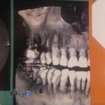 دندانپزشکی دکتر منصور خراسانی