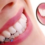 مطب دندانپزشکی زیبایی دکتر فرهاد کاظملو