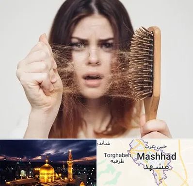 دکتر ریزش مو در مشهد