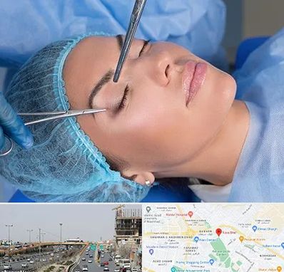 جراحی لیفت ابرو در بلوار توس مشهد