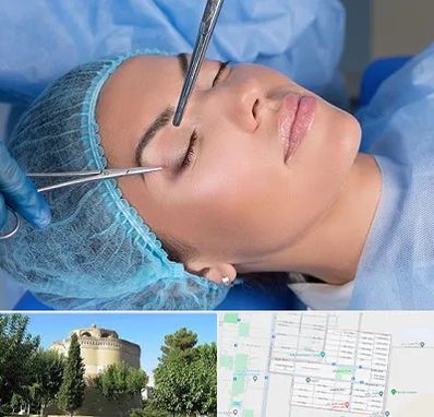جراحی لیفت ابرو در مرداویج اصفهان