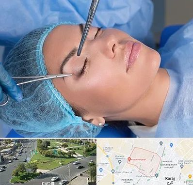 جراحی لیفت ابرو در شاهین ویلا کرج