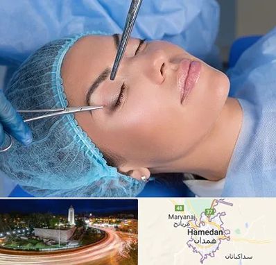 جراحی لیفت ابرو در همدان