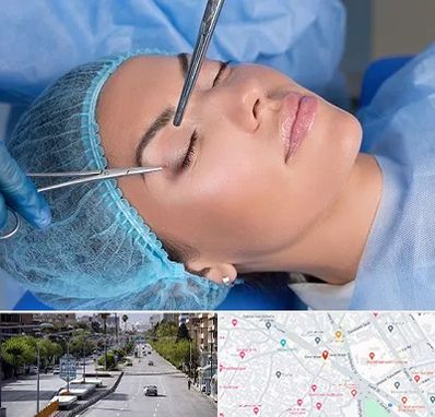 جراحی لیفت ابرو در خیابان زند شیراز