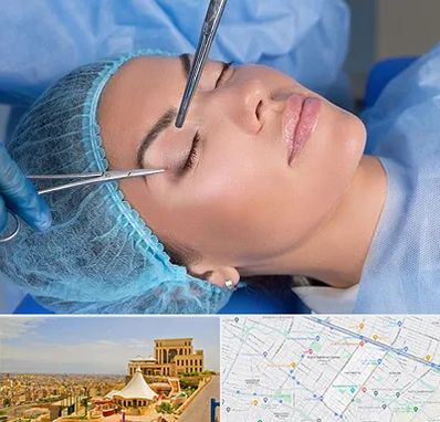جراحی لیفت ابرو در هاشمیه مشهد