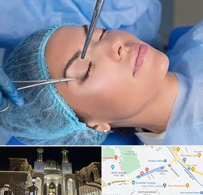 جراحی لیفت ابرو در زرگری شیراز