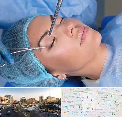 جراحی لیفت ابرو در منطقه 7 تهران 