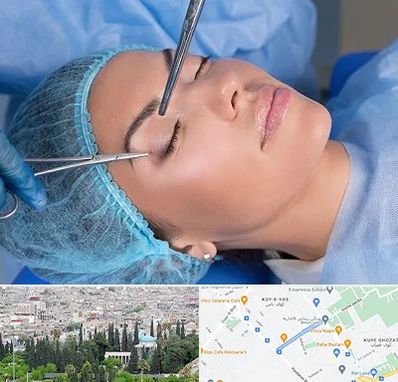جراحی لیفت ابرو در محلاتی شیراز